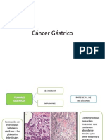 Cáncer Gástrico