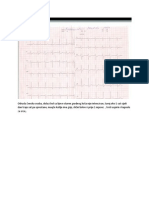 Ischemic Heart Disease 2