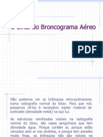 O Sinal Do Broncograma Aéreo