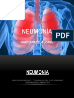 Neumonia S