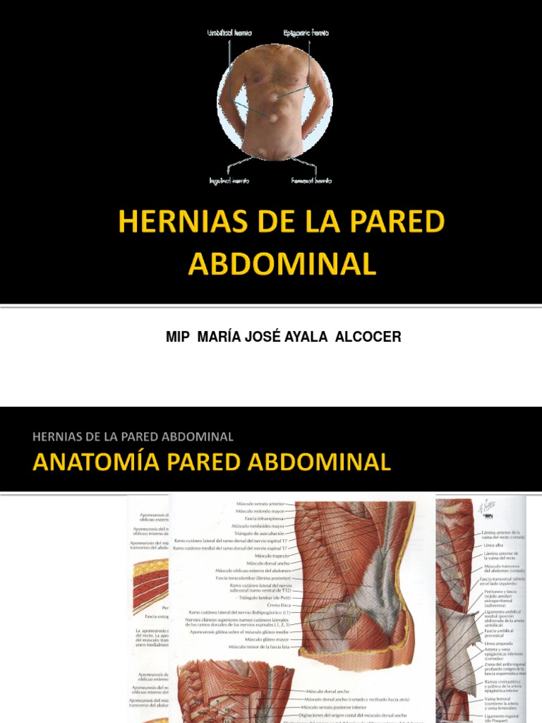 Hernias de La Pared Abdominal | PDF | Abdomen | Enfermedades y trastornos