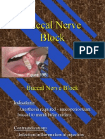 Buccal Nerve Block