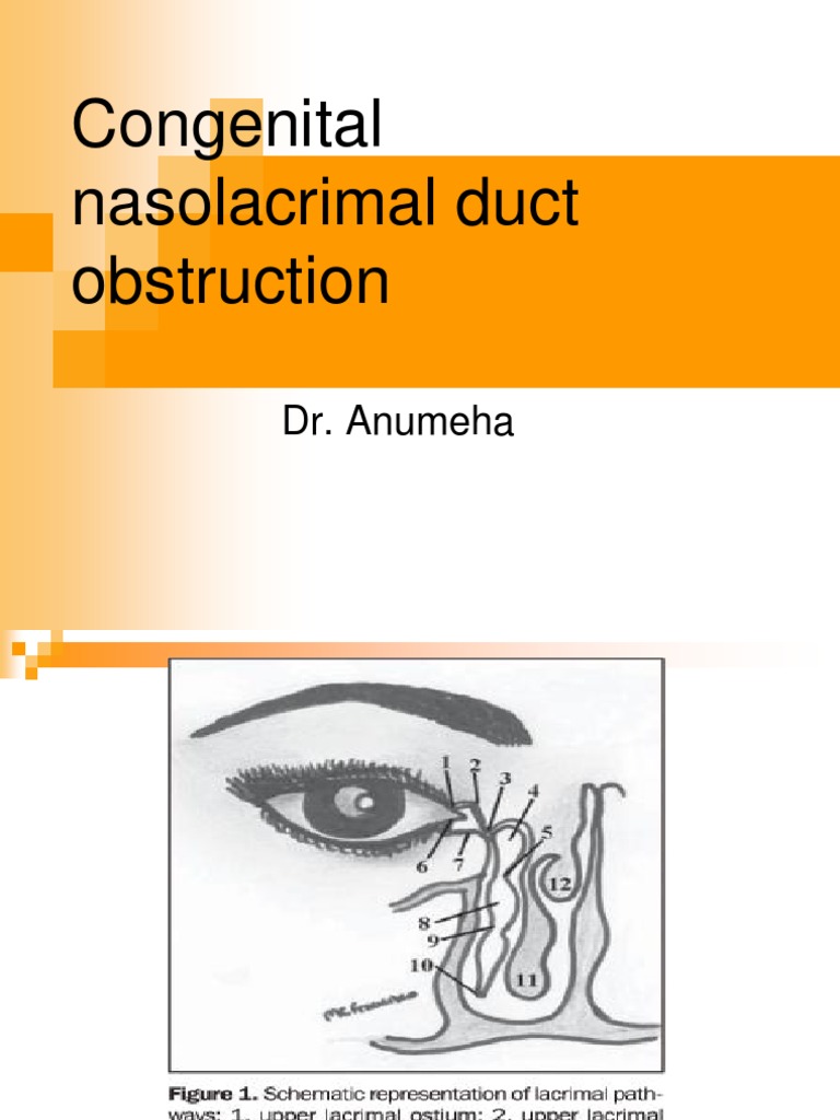 Congenital Nasolacrimal Duct Obstruction | Medical Specialties ...