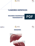 7b Tumores Hepaticos. Fisiopatologia y Tratamientos. Resumen. Curso