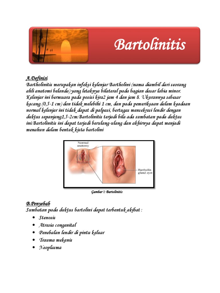 Bartholinitis Bartholinitis