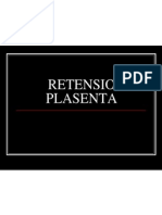 Retensio Plasenta PDF