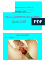 fistules anales _ le choix des armes en 2007