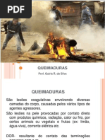 AULA 4 QUEIMADURAS.pptx