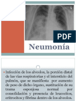 Neumonia