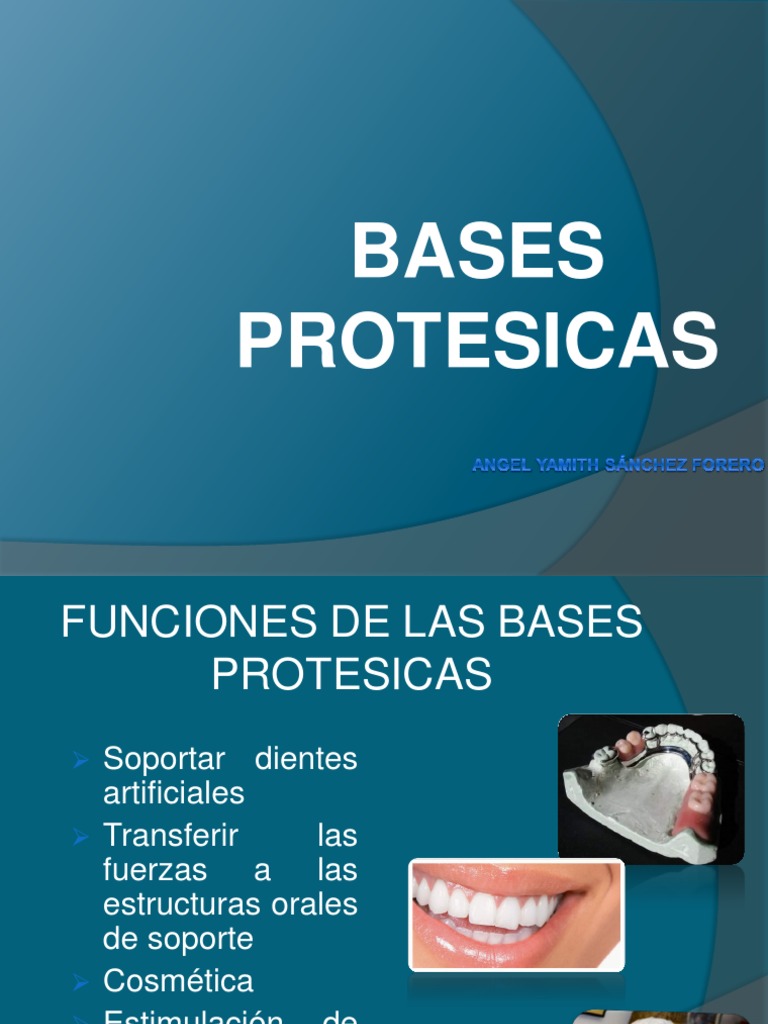 Tipos y Funciones de Bases Protésicas | PDF | Hogar, jardinería y ...