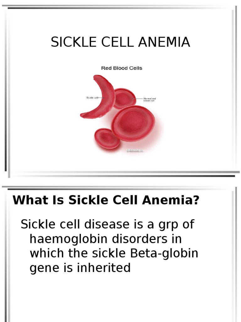 Overview of Sickle Cell Anemia | PDF | Anemia | Tissue (Biology)