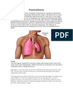 Pneumothorax..final doc. for case pres.doc