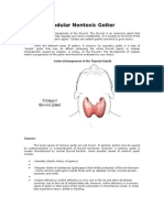 Nodular Nontoxic Goiter