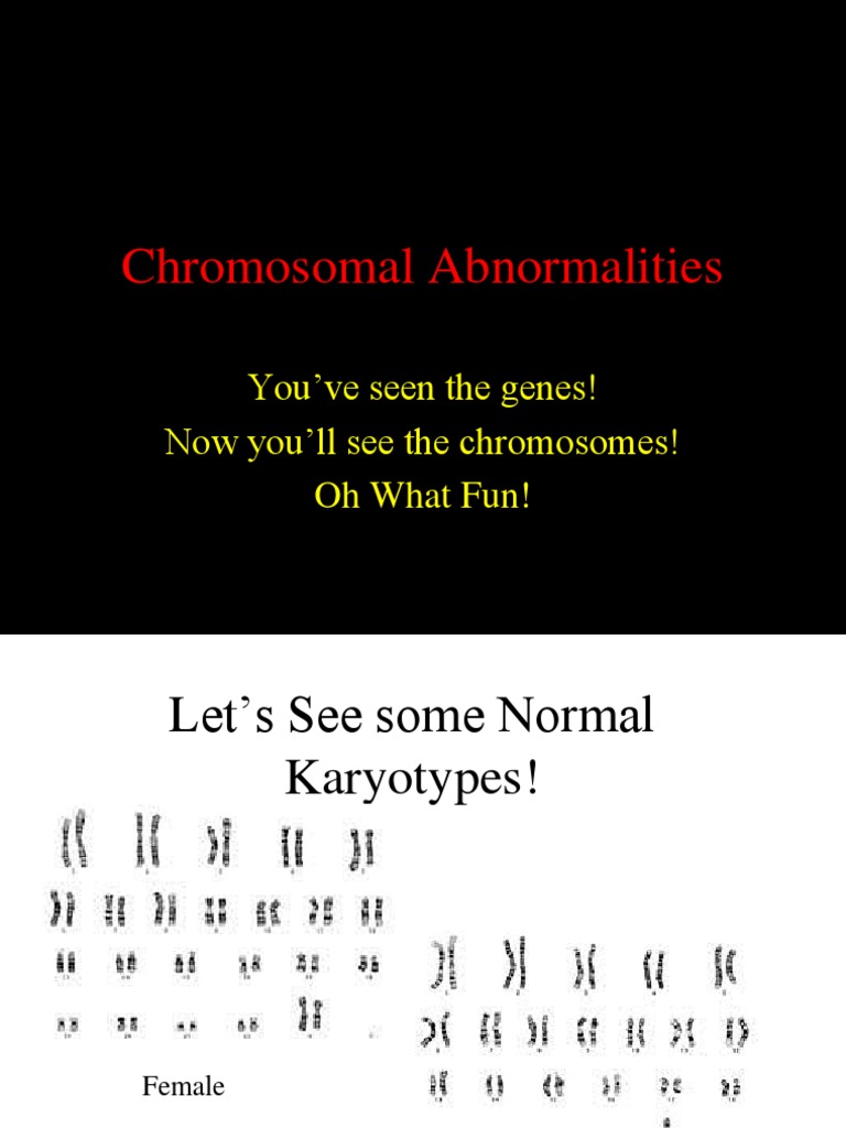 Chromosomal Abnormalities | PDF | Down Syndrome | Genetics