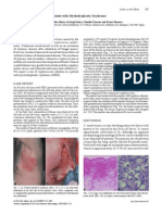 Cryptococcal Cellulitis in A Patient With Myelodysplastic Syndrome