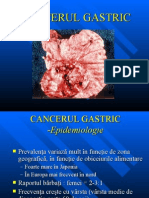 Stomac.cancer.gastric.ro