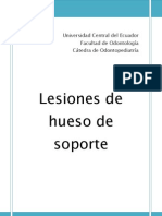 Lesiones de Hueso de Soporte