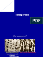 Osteoporosis