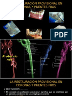 La RestauraciÓn Provisional en Coronas y Puentes Fijos