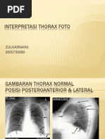 Download Interpretasi Thorax Foto by Sinta Sintaa SN131828264 doc pdf