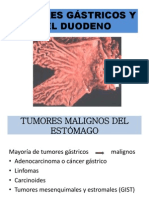 Cancer Gastrico Grupo 2