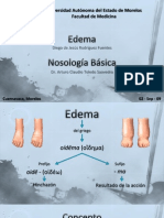 Exposición-10---Edema-(Rodríguez-Fuentes-Diego-de-Jesús)