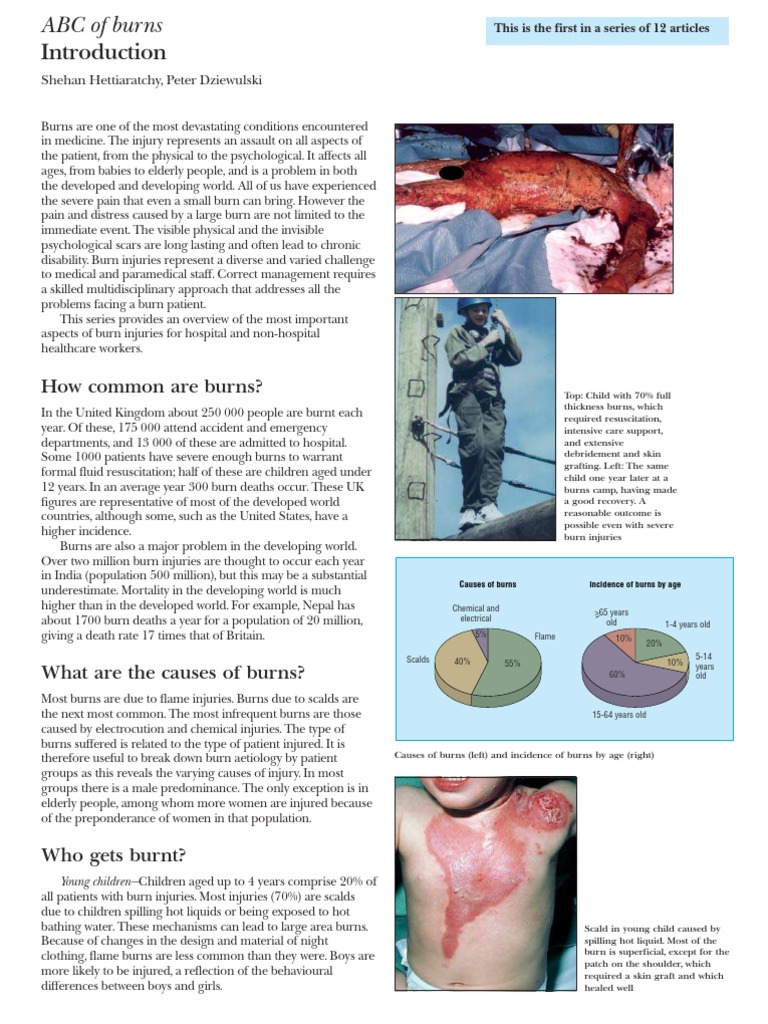 ABC of Burns Burn High Voltage