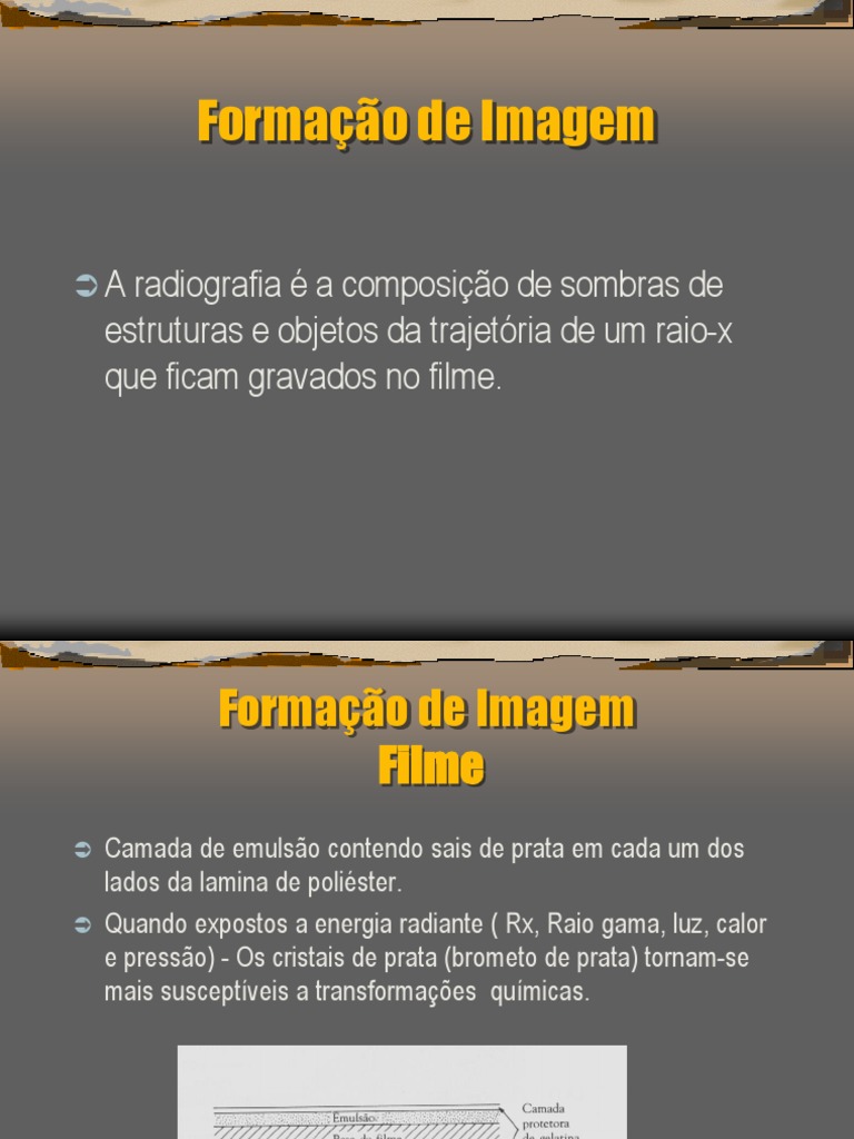 Formação de Imagem Radiográfica: Princípios e Técnicas | PDF | Ciências ...
