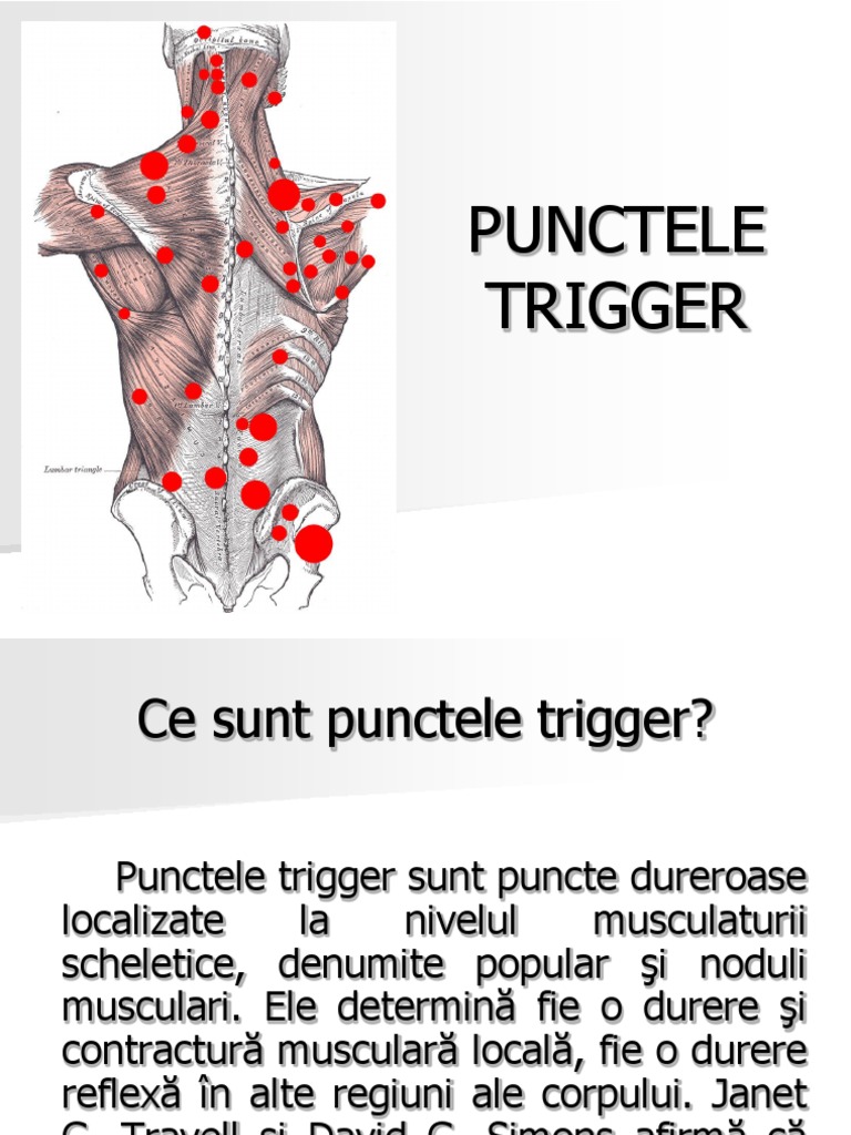 Trigger Point | PDF