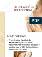 Acne Juvenil