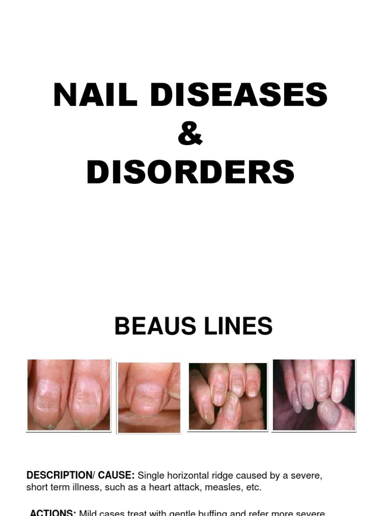 Overview of Nail Diseases and Disorders | PDF | Nail (Anatomy) | Dermatitis