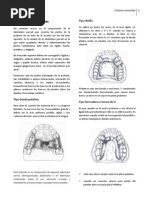 Corona Ansa y Banda Ansa | PDF | Odontología | Diente