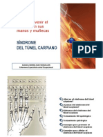 Sindrome Del Tunel Carpiano PDF