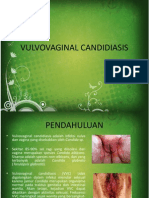 Vulvovaginal Candidiasis