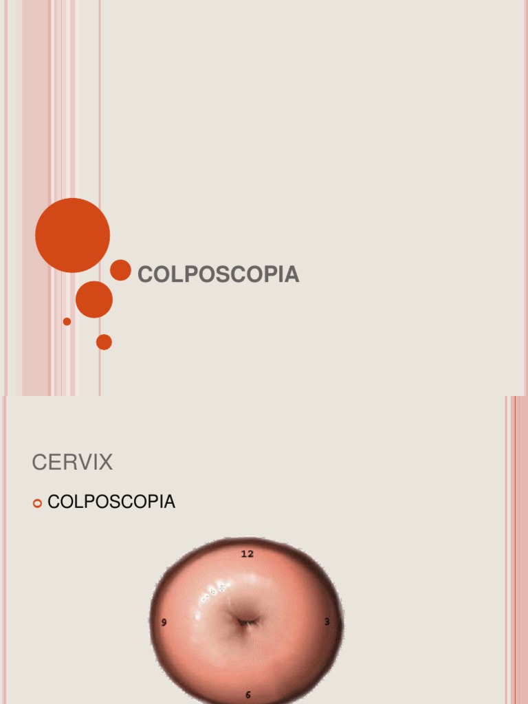 Colpos | PDF