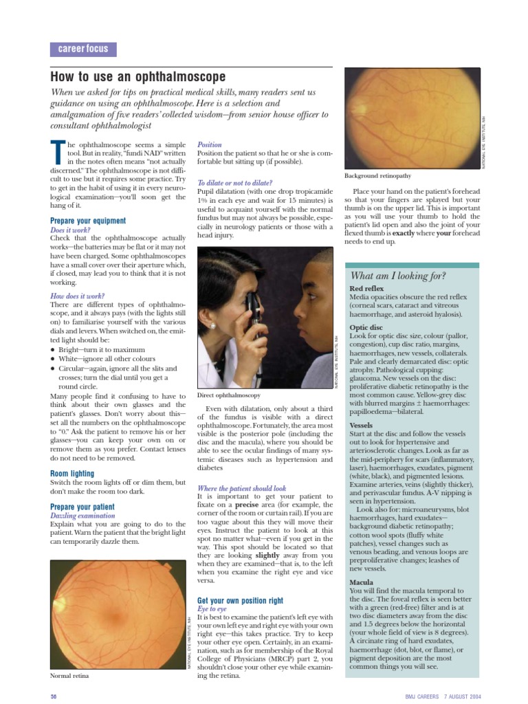 How To Use Ophthalmoscope PDF