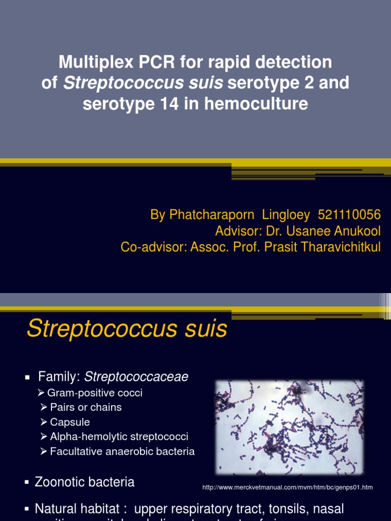 Multiplex PCR For Rapid Detection of Streptococcus Suis Serotype 2 and ...