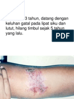 Ds Dermatitis 1