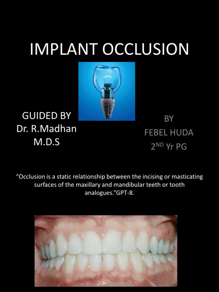 Implant Occlusion Final Ppt Dental Implant Tooth