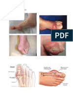 Gambar Gout Lampiran