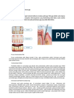 Contoh Bioadhesive Di Kedokteran Gigi