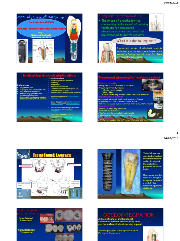 DR Ghazy 2013 Implant Lectures For 4th Year Students PDF Dental Implant Dentures