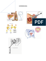 CATETERISMO VESICAL