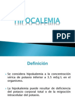 HIPOCALEMIA