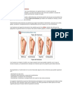 Clasificación y Tipos de Fracturas