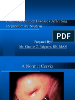 Common Cancer Diseases Affecting Reproductive System