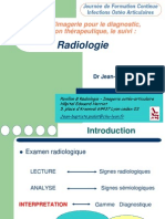 Abces Sous Periosté