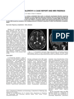 Wernicke'S Encephalopathy: A Case Report and Mri Findings: Key-Words: Pregnancy, Complications - Brain, Diseases