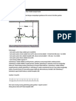 Belajar EKG 1