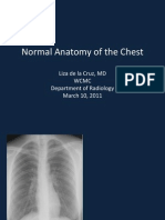 Normal Anatomy of The Chest
